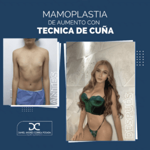 AYD MAMOPLASTIA-39