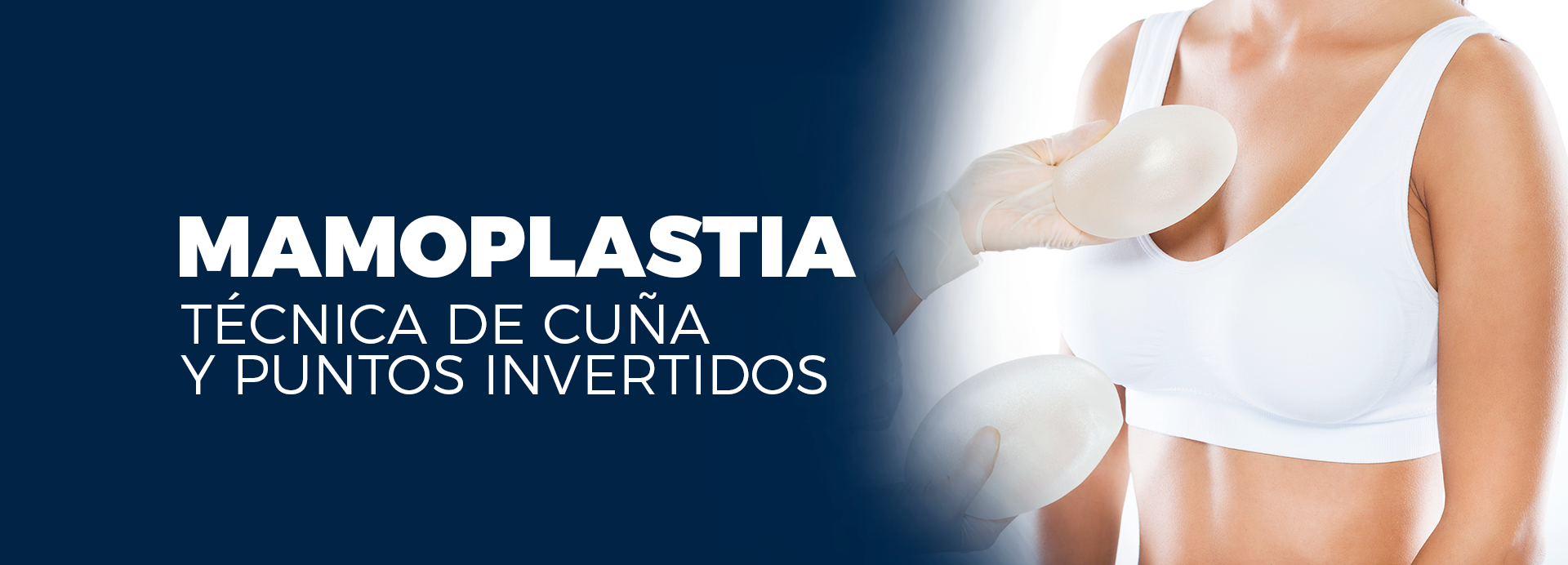 tecnica de cuña