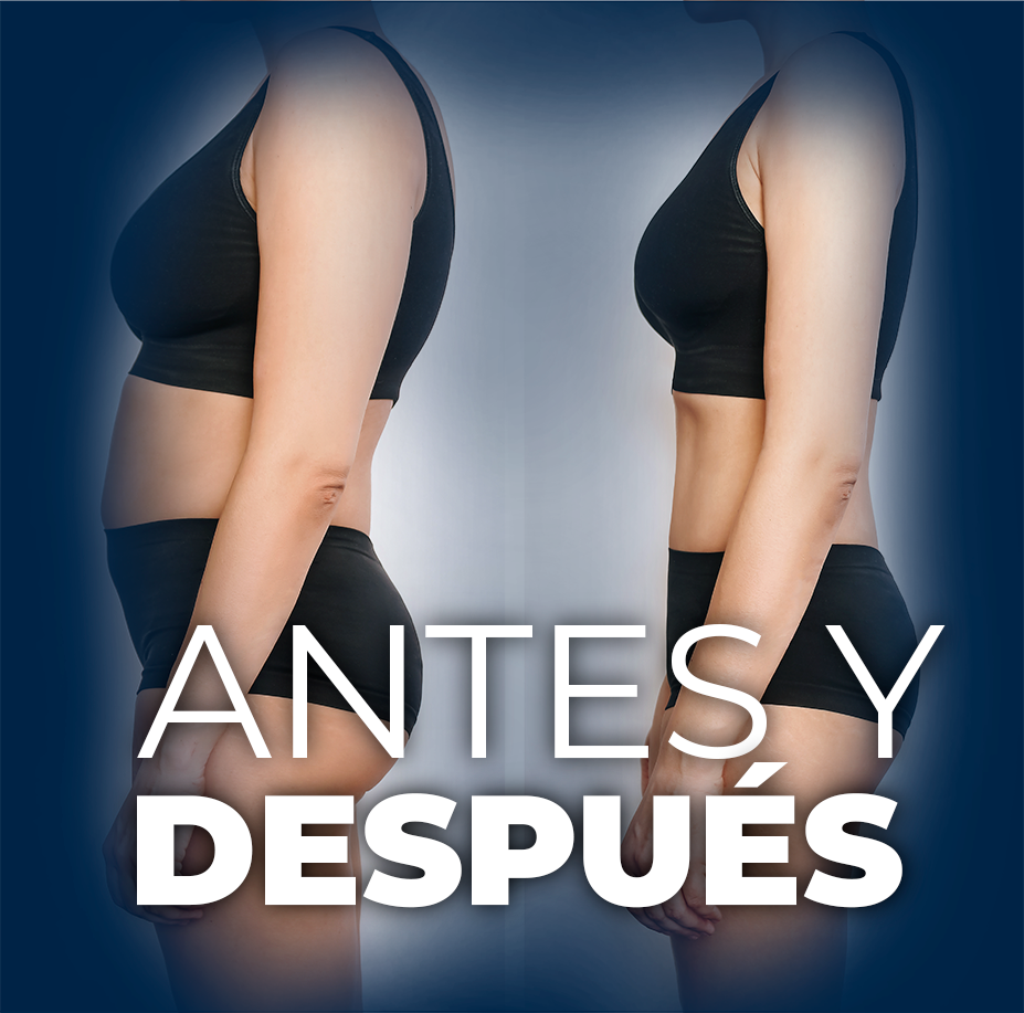 ANTES Y DESPUÉS