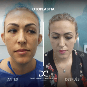 NUEVO FEED DR. CORREA-39