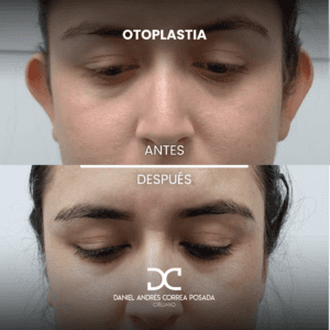 NUEVO FEED DR. CORREA-40
