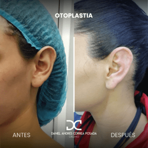 NUEVO FEED DR. CORREA-41