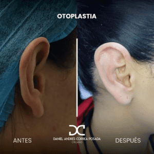 NUEVO FEED DR. CORREA-42