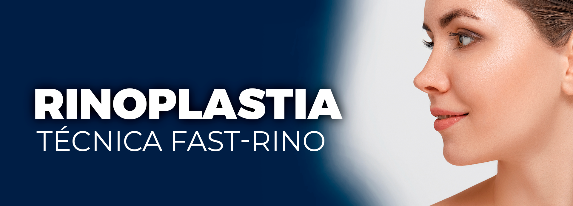RINOPLASTIA TECNICA FAST RINO