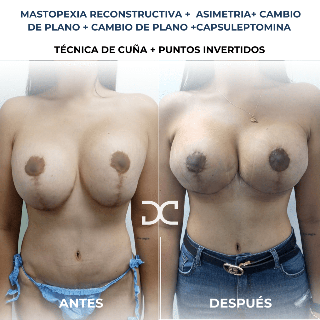 Copia de Añadir un subtítulo (10)