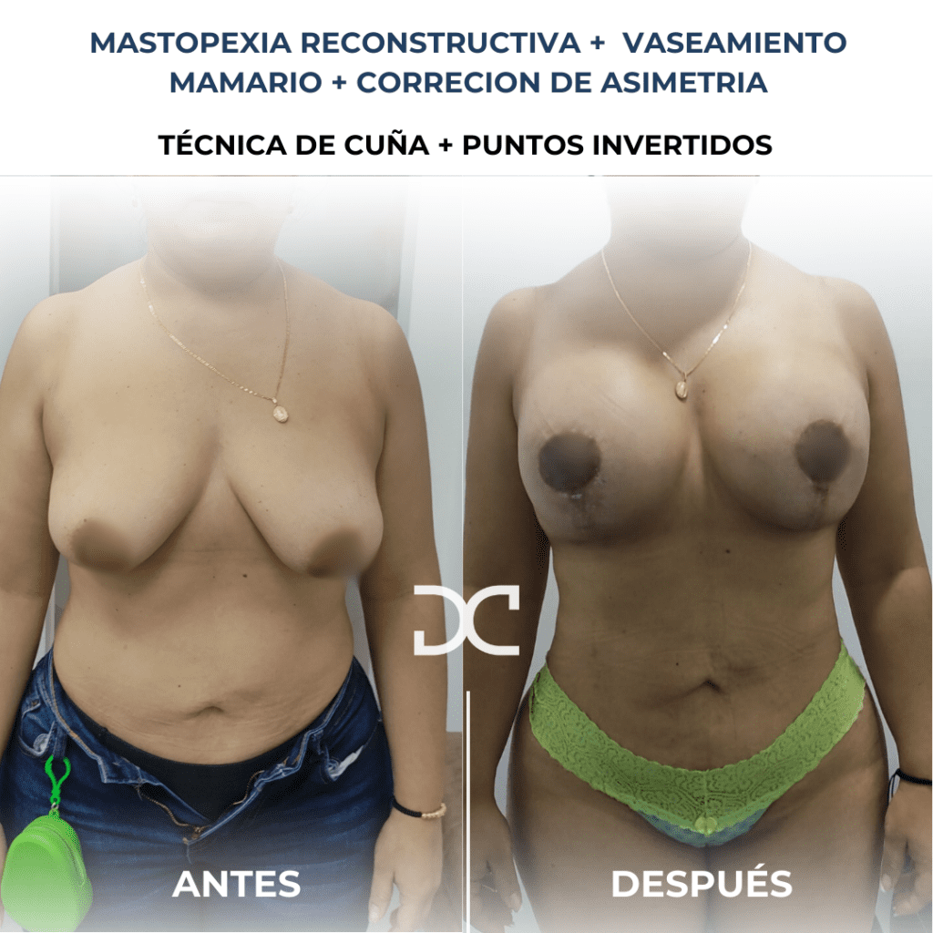 Copia de Añadir un subtítulo (3)