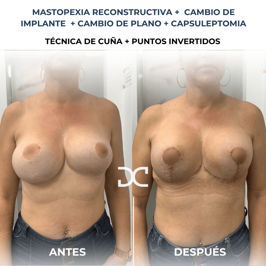 Copia de Añadir un subtítulo (4)