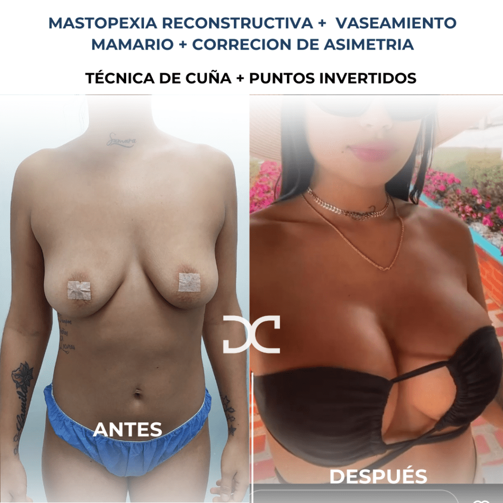 Copia de Añadir un subtítulo (5)
