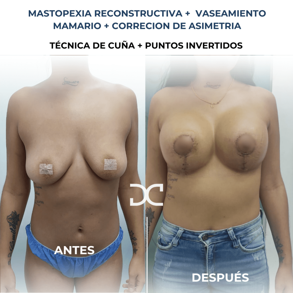 Copia de Añadir un subtítulo (6)