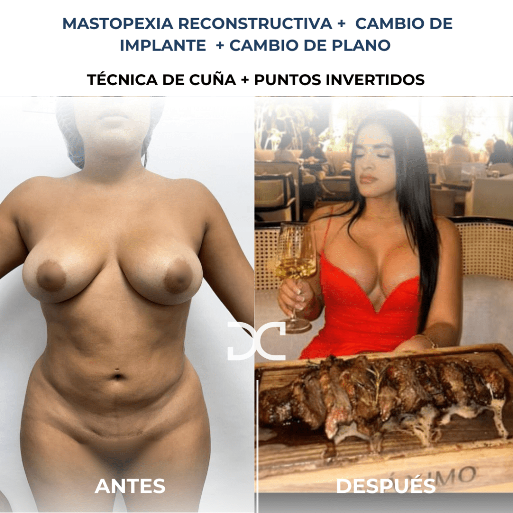 Copia de Añadir un subtítulo (7)