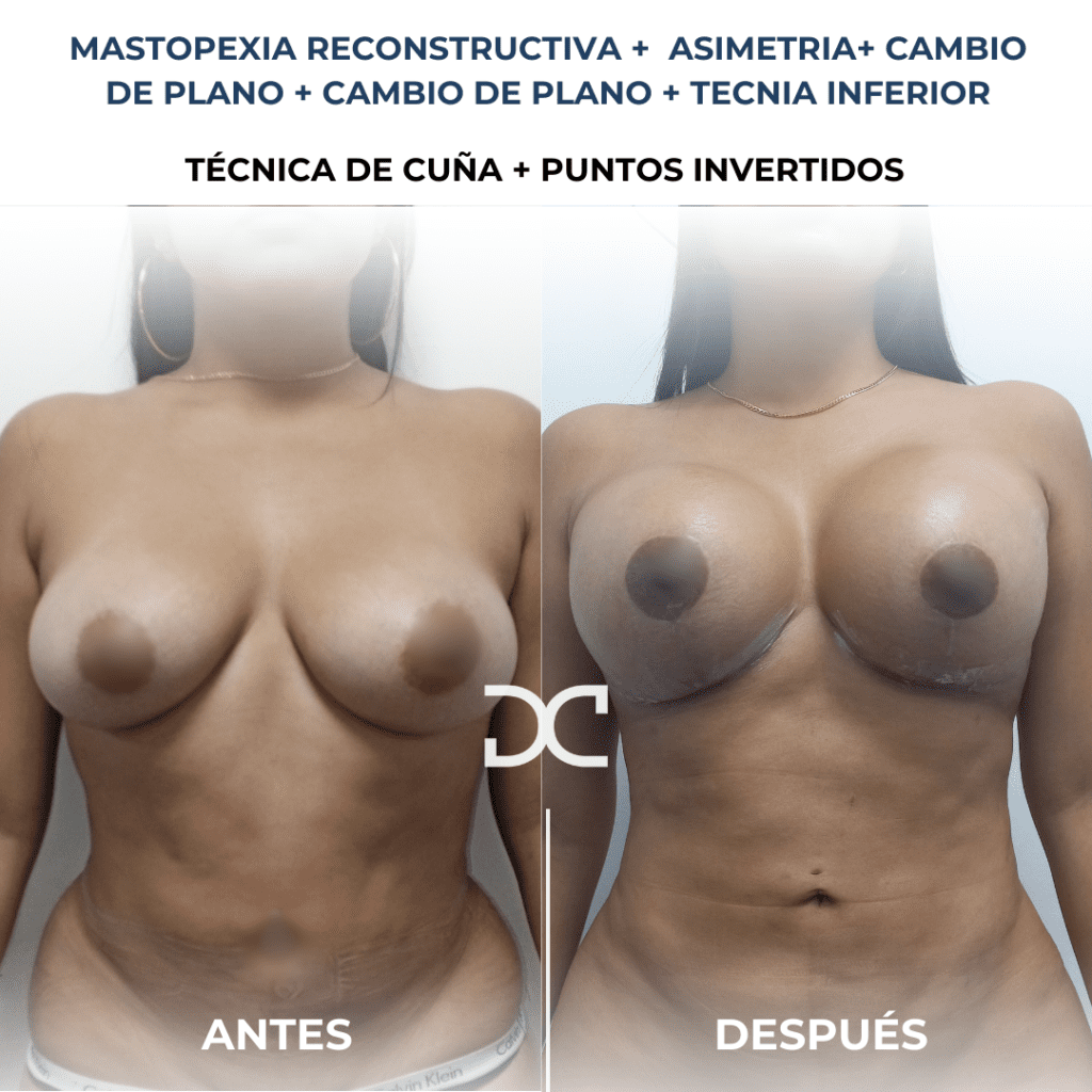 Copia de Añadir un subtítulo (9)
